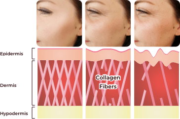 Image Why Are We Not Getting Enough Collagen?
