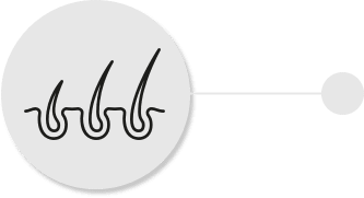 Image Combat Hair Loss: