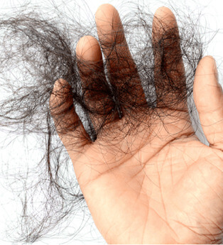 Image The Impact of Hair Loss on <br> Your Well-Being