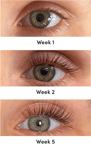 Stunni Trasnformation mb