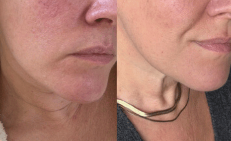 Image review of Rochelle M. - Jacksonville, FL