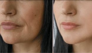 Image review of Rochelle M. - Jacksonville, FL