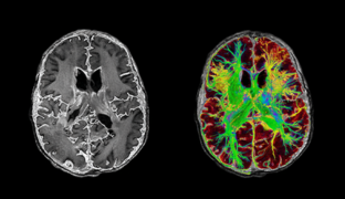 Image review of John F. - Denver, CO