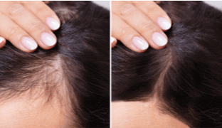 Image review of Ava K. - Miami, FL