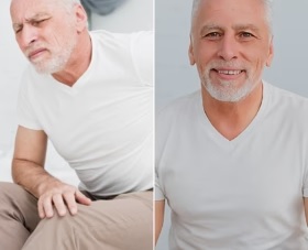 Before After 1