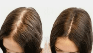 Image review of Jackson R. - Denver, CO