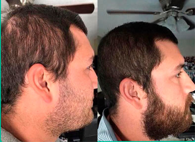 Image Finally, an Effective & Science-Backed Solution for Hair Growth!