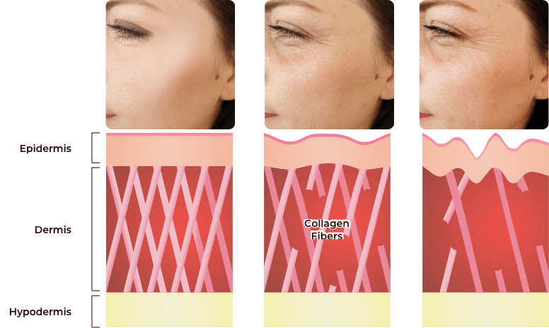 Image Why Are We Not Getting Enough Collagen?