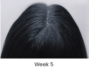 Week 5 Progress